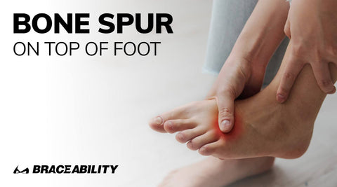 Bone Spurs on Top of Foot: Causes, Symptoms, and Treatments