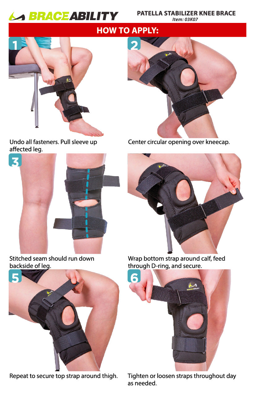 Example of a patella stabilizing brace that can be used for
